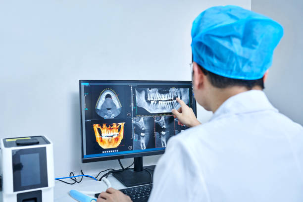 Best Tooth Pain Emergency Relief  in Mpbell, CA