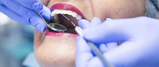Best Knocked-Out Tooth Emergency  in Mpbell, CA
